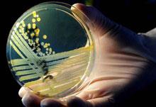 Batterio killer resistente agli antibiotici